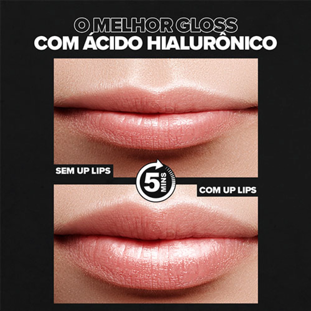 Monte Seu Kit Com 4 Glosses Up Lips Up Lips Gloss Labial Com Ácido